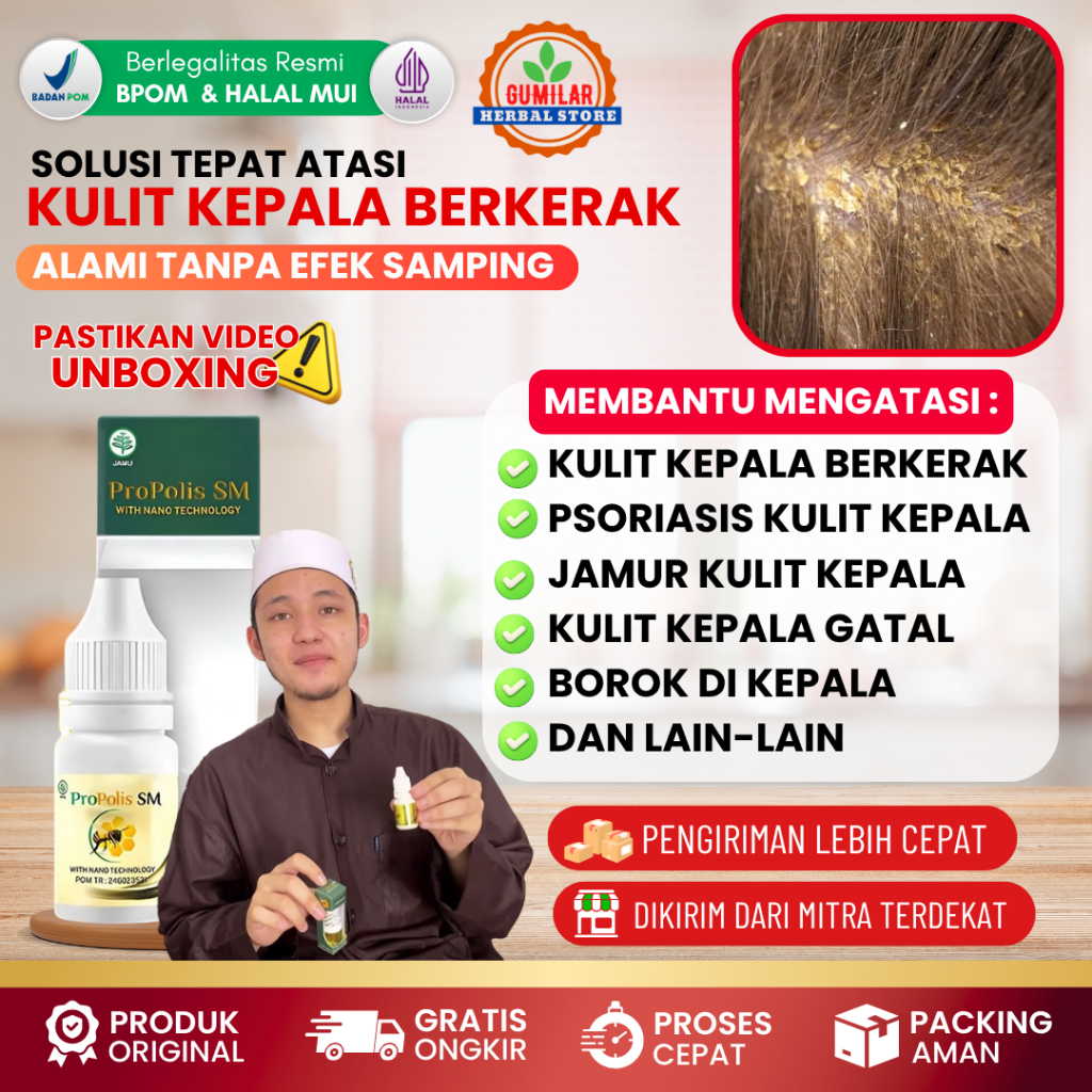 Obat Tetes Kulit Kepala Berkerak Kering Bersisik - Obat Kulit Kepala Gatal - Obat Kulit Kepala Psori