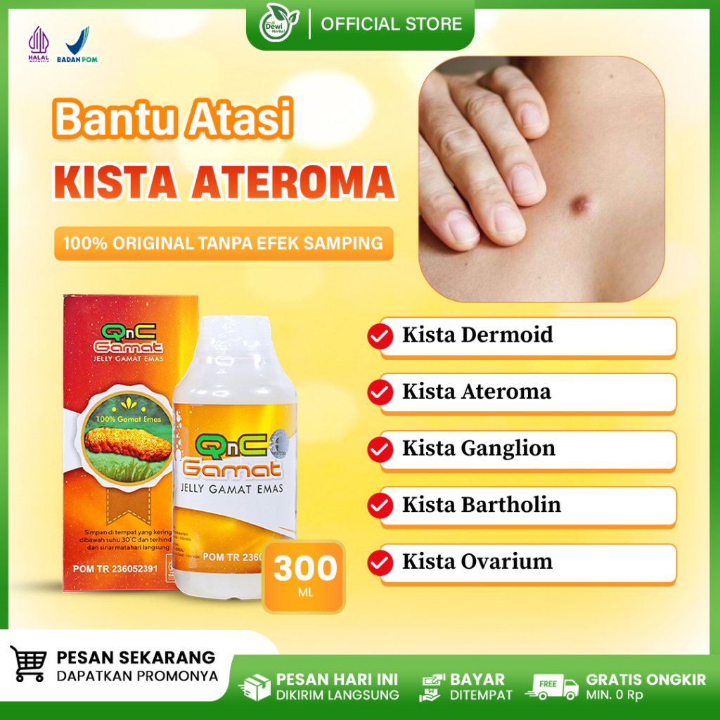 Obat Kista Dermoid - Kista Ateroma - Kista Ganglion - Obat Penghancur Benjolan Kista - Jelly Gamat