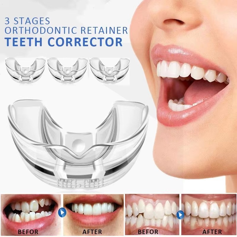 Perapih Gigi Transparan Teeth Trainer Alignment Orthodentic Retainer Rapikan Gigi Tanpa Behel