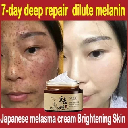 Cream flek hitam membandel bpom krim penghilang flek hitam serum flek hitam membandel 30g cream peng