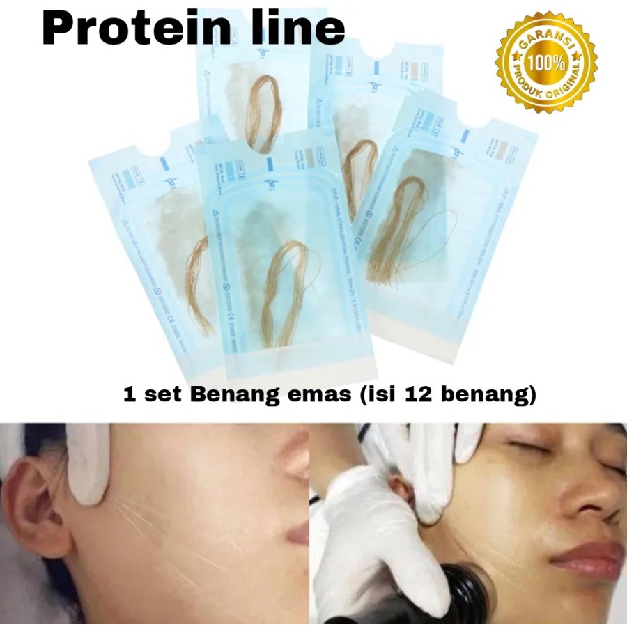 TANAM BENANG KOLAGEN TANPA JARUM KOREA BPOM | Gold Protein Line Lifting Wajah Pengencang Kulit
