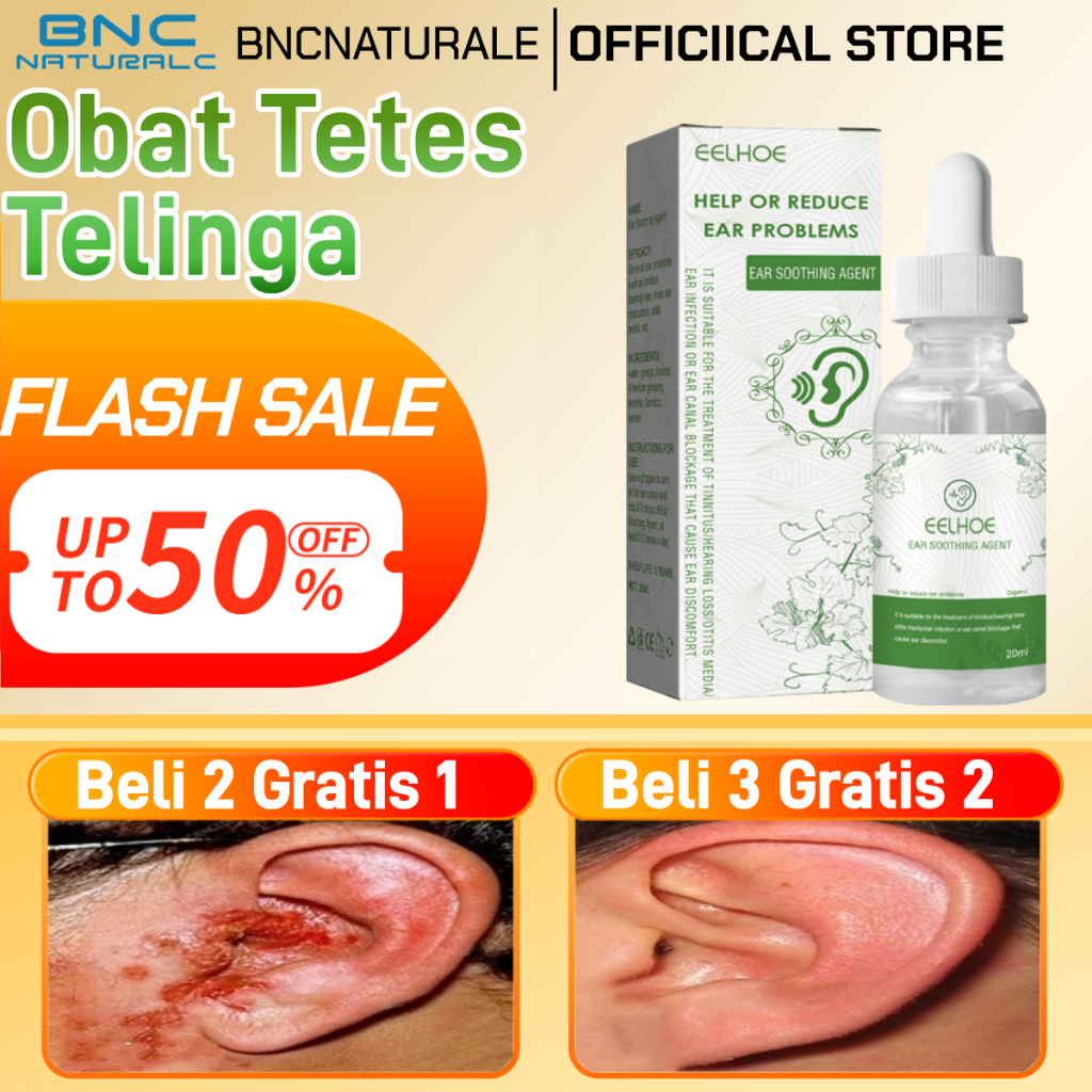 Bncnaturale Obat Tetes Telinga Pembersih Kotoran Pembersih Telinga Bayi Obat Sakit Telinga Bernanah 