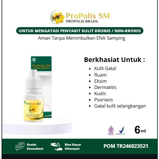 Obat Kutil / Kutilan (Penghilang - Penumpas Kutil Di Siku, Telapak, Dan Jari-jari Tangan Atau Kaki -