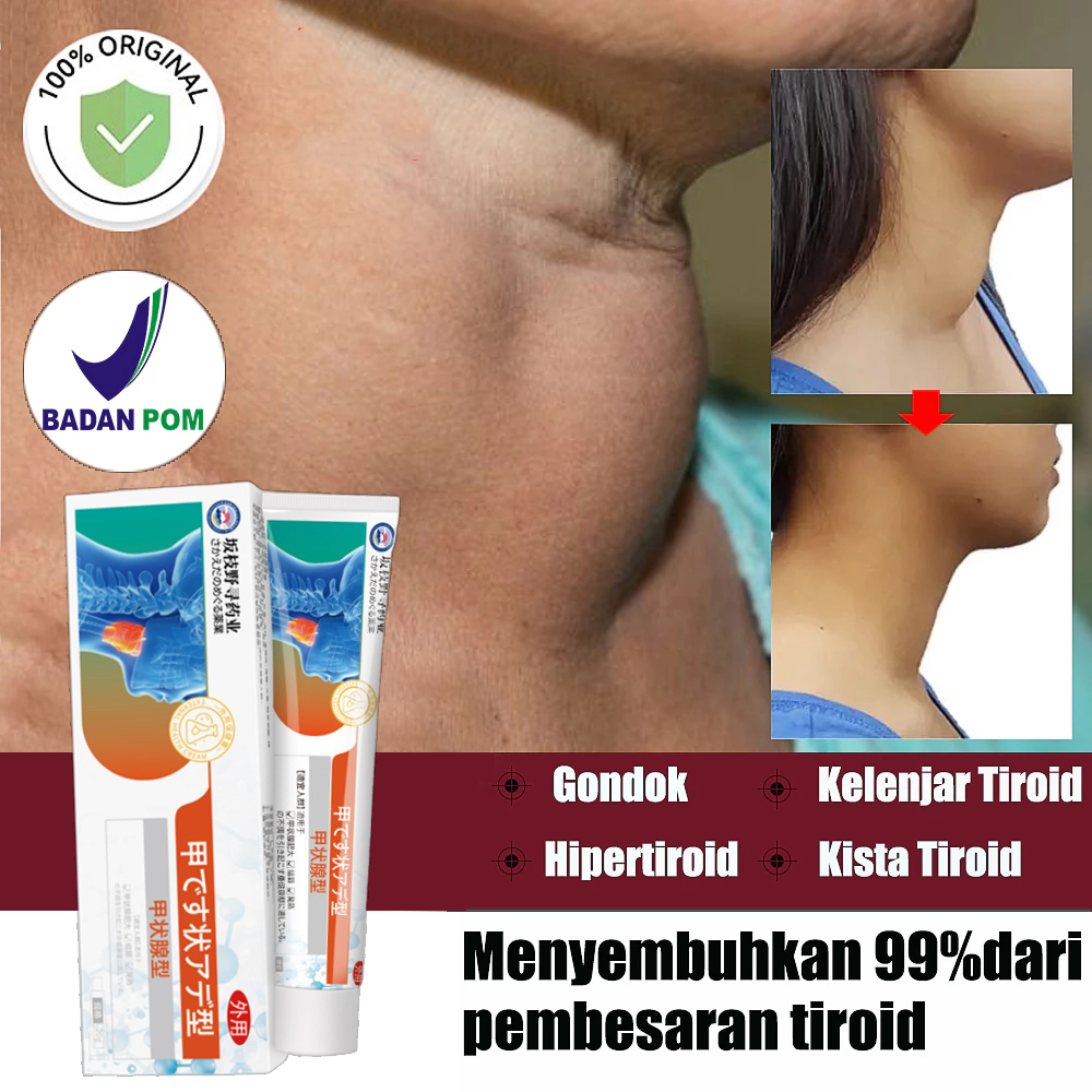 Salep Tiroid 20g Berlaku Untuk Gondok Hipertiroid Kelenjar/Mengurangi Pembengkakan Hipertiroid