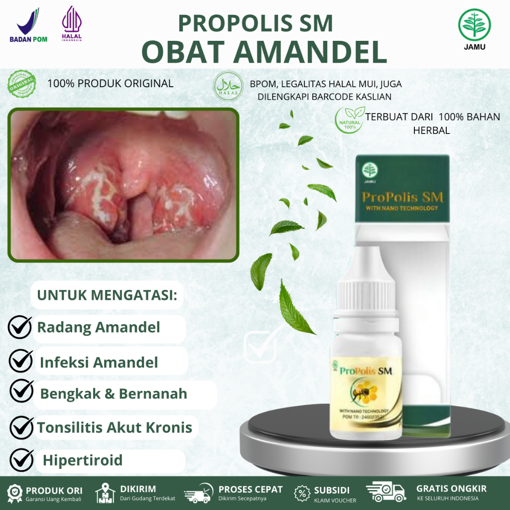 Propolis SM Untuk Amandel Tonsilitis Akut Kronis, Hipertiroid, Radang Amandel, Infeksi Amandel, Saki