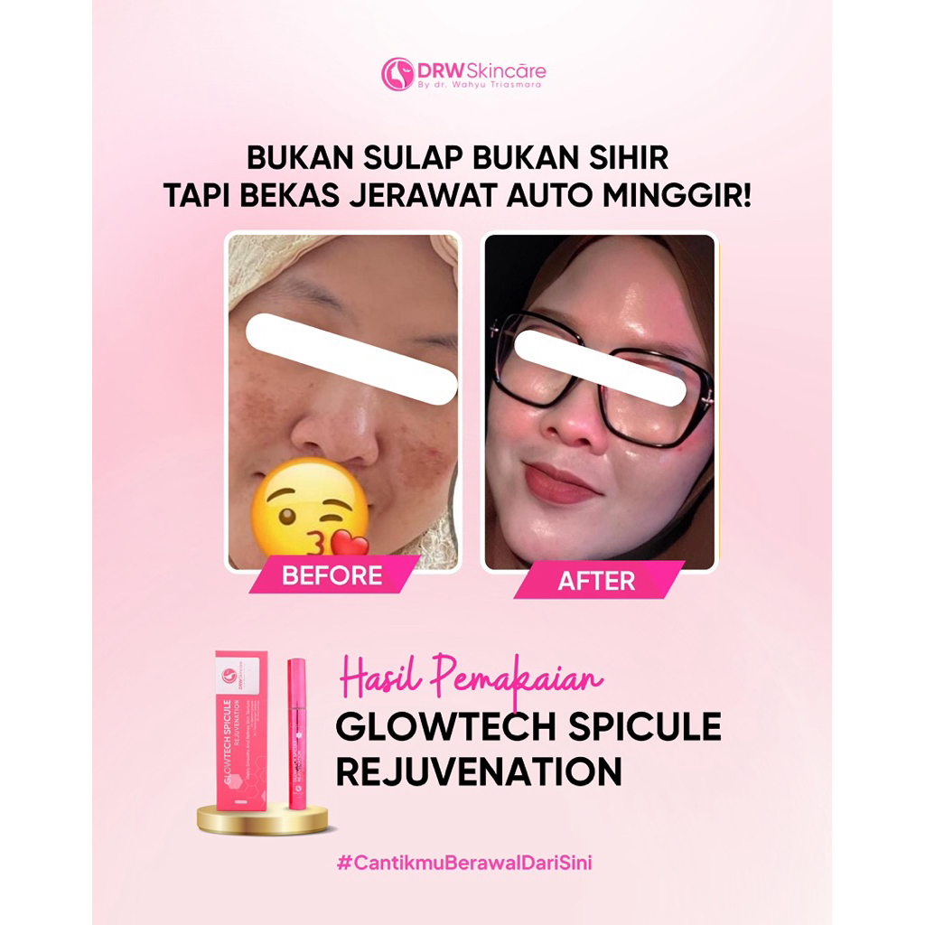 @Drw Skincare Produk Original 100% BPOM DRW Glowtech Spicule Rejuvenation