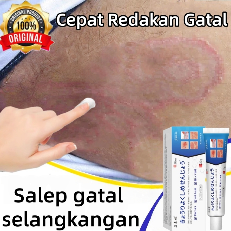 Salep gatal selangkangan Salep eksim Saleb gatal paling ampuh Menghilangkan Kurap dan Jamur