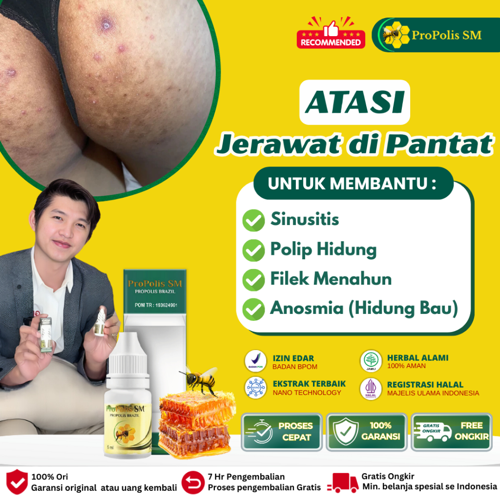 Propolis Sm - Obat Pantat Gatal, Obat Pantat Hitam Burik, Obat Pantat Bruntusan, Obat Jerawat Di Pan