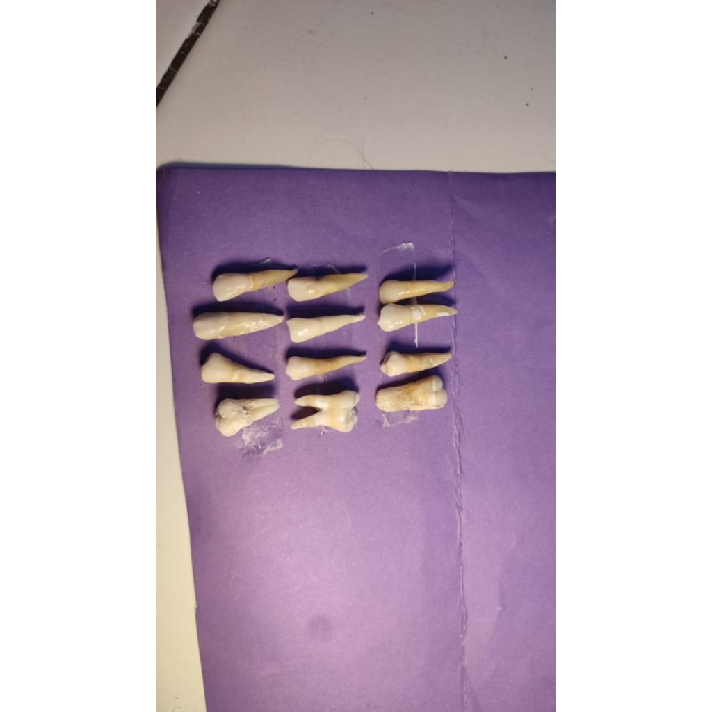 wiwi umy yogyakarta m bawah ada 2 m atas ada 1 3 set