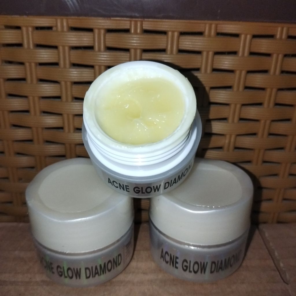Cream Acne Glow Diamond/AGD/Acne Glowing Diamond Original