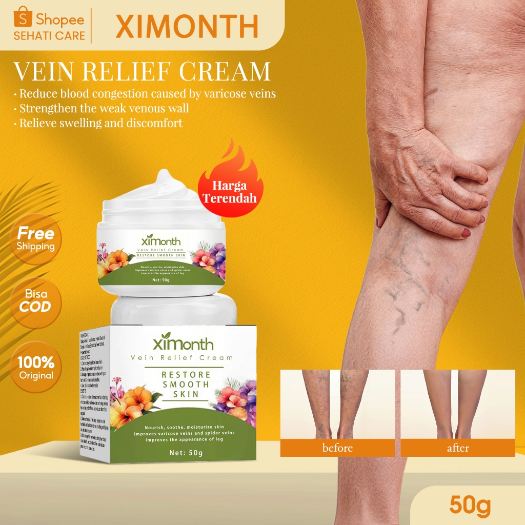 Ximonth Vein Relief Cream 50g Krim Perawatan Vena Improves Varicose Veins And Spider Veins Treat Blo