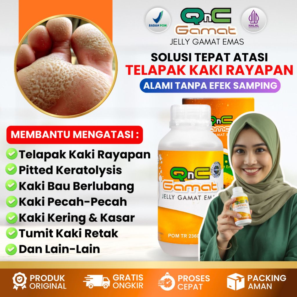 QNC JELLY GAMAT Obat Tetes Oles Kaki Rayapan Bau, Obat Pitted Keratolysis, Obat Telapak Kaki Bolong 