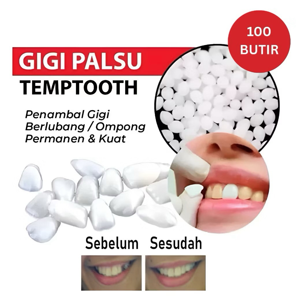 [100 Butir] Penambal Gigi Berlubang Gigi Depan Ompong 100% Gigi Palsu Original Penutup Gigi