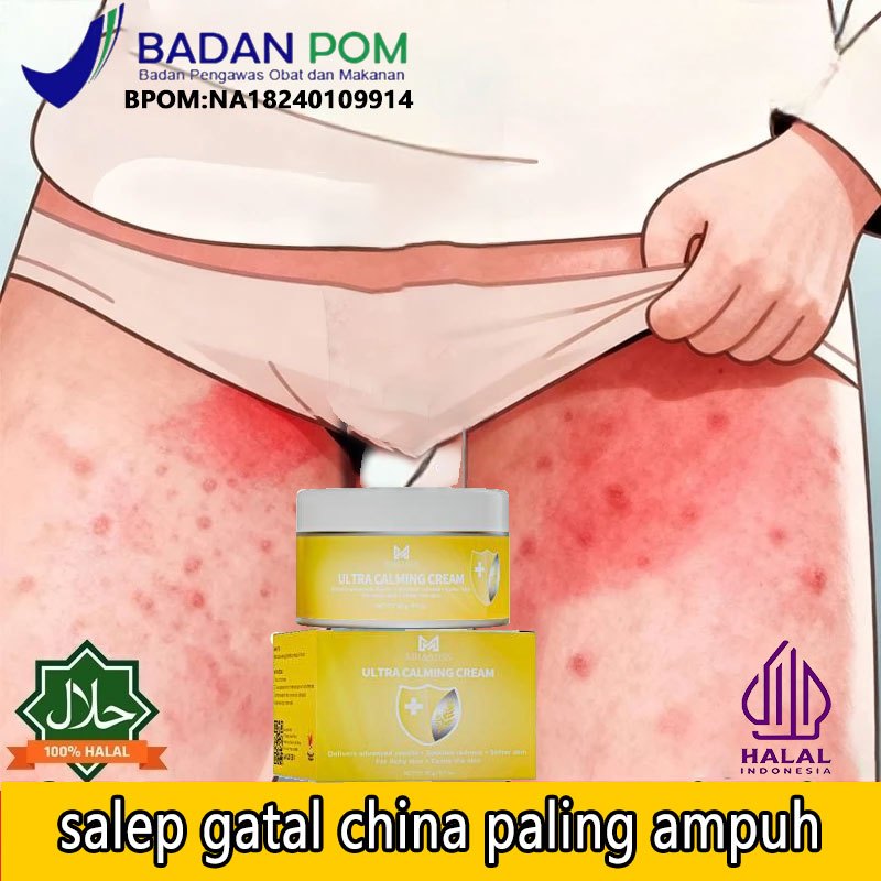 Obat gatal selangkangan dan hitam salap gatal china salep kulit salep eksim kering dan gatal 20g sal