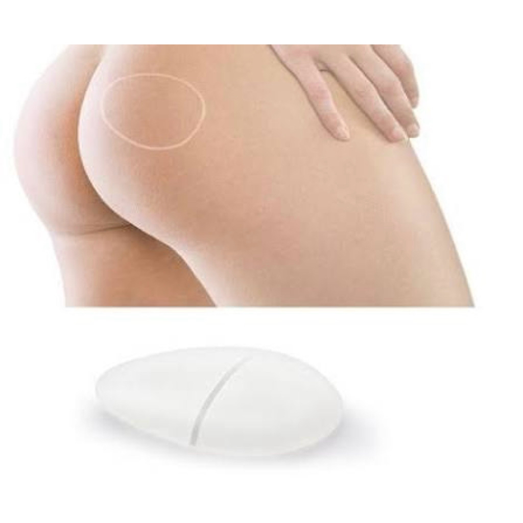 implant pantad butt gluteal implant