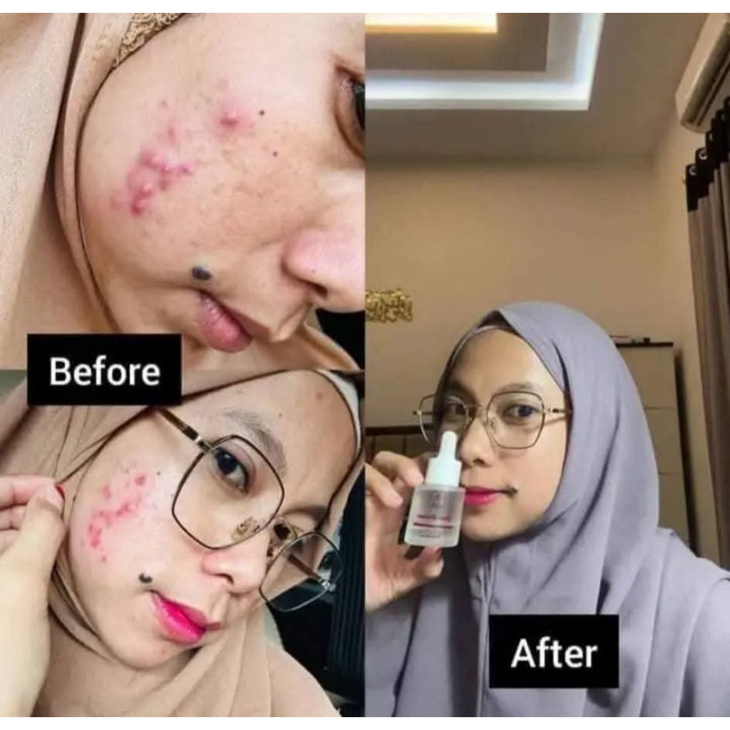 RK Cosmetics RK glow Serum Premium