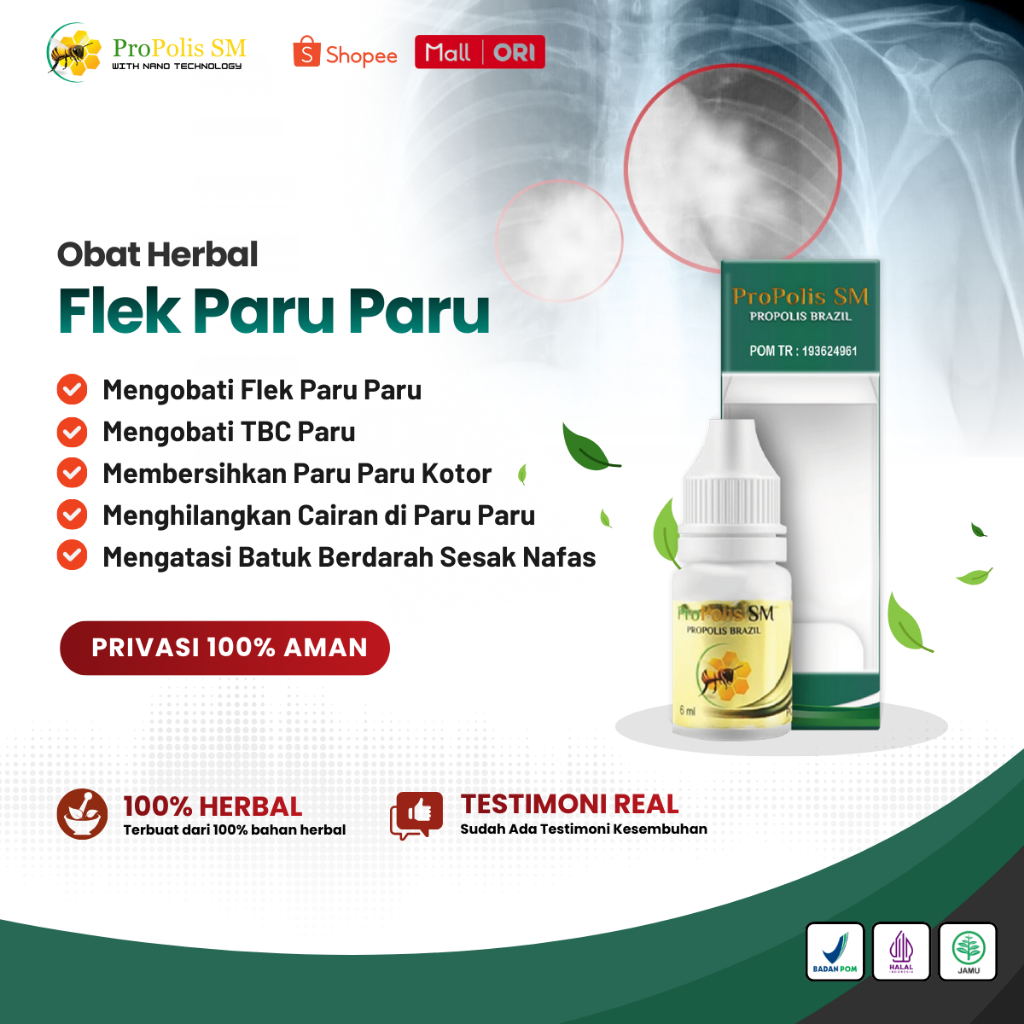 Propolis SM - Obat Flek Paru Paru, Pembersih Paru Paru, Penghilang Cairan di Paru Paru Anak & Dewasa