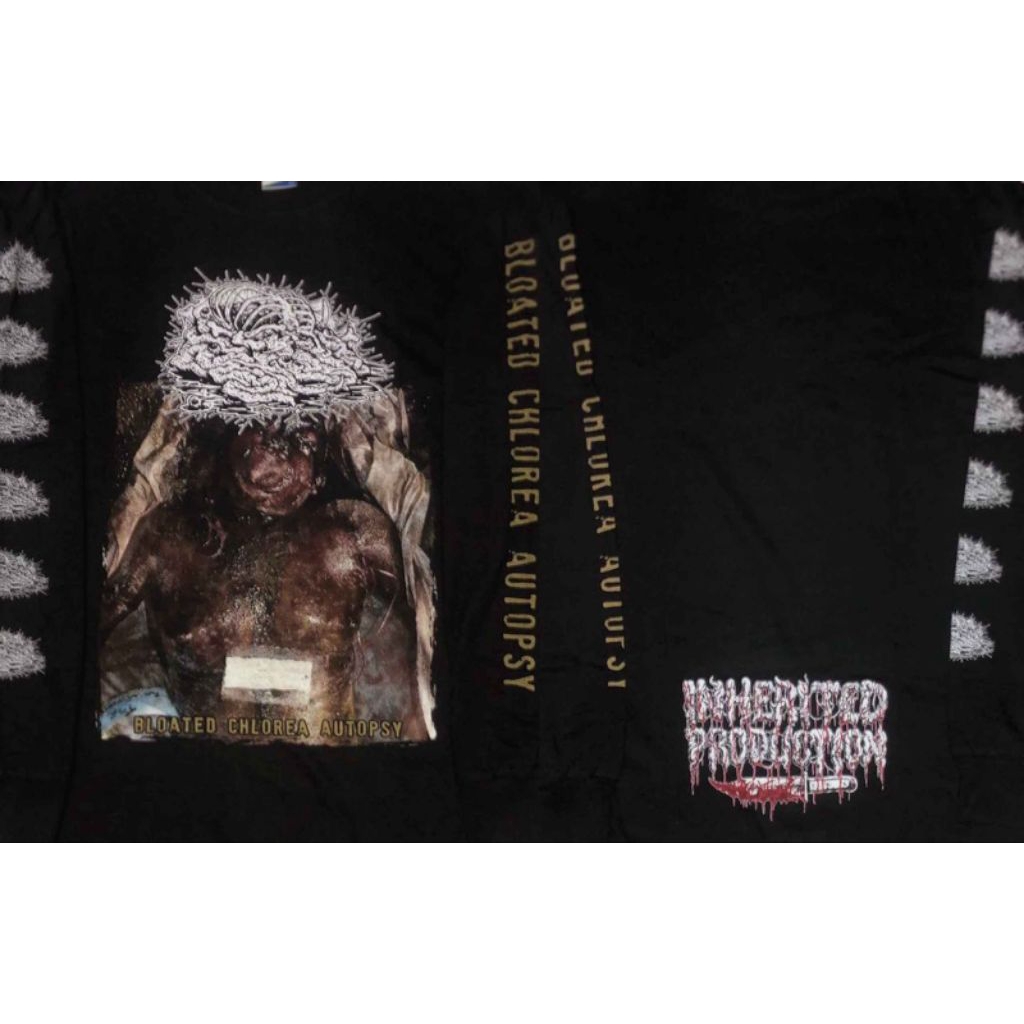 LS – BOTCHED ANASTOMOSIS J-POUCH – BLOATED CHLOREA AUTOPSY
