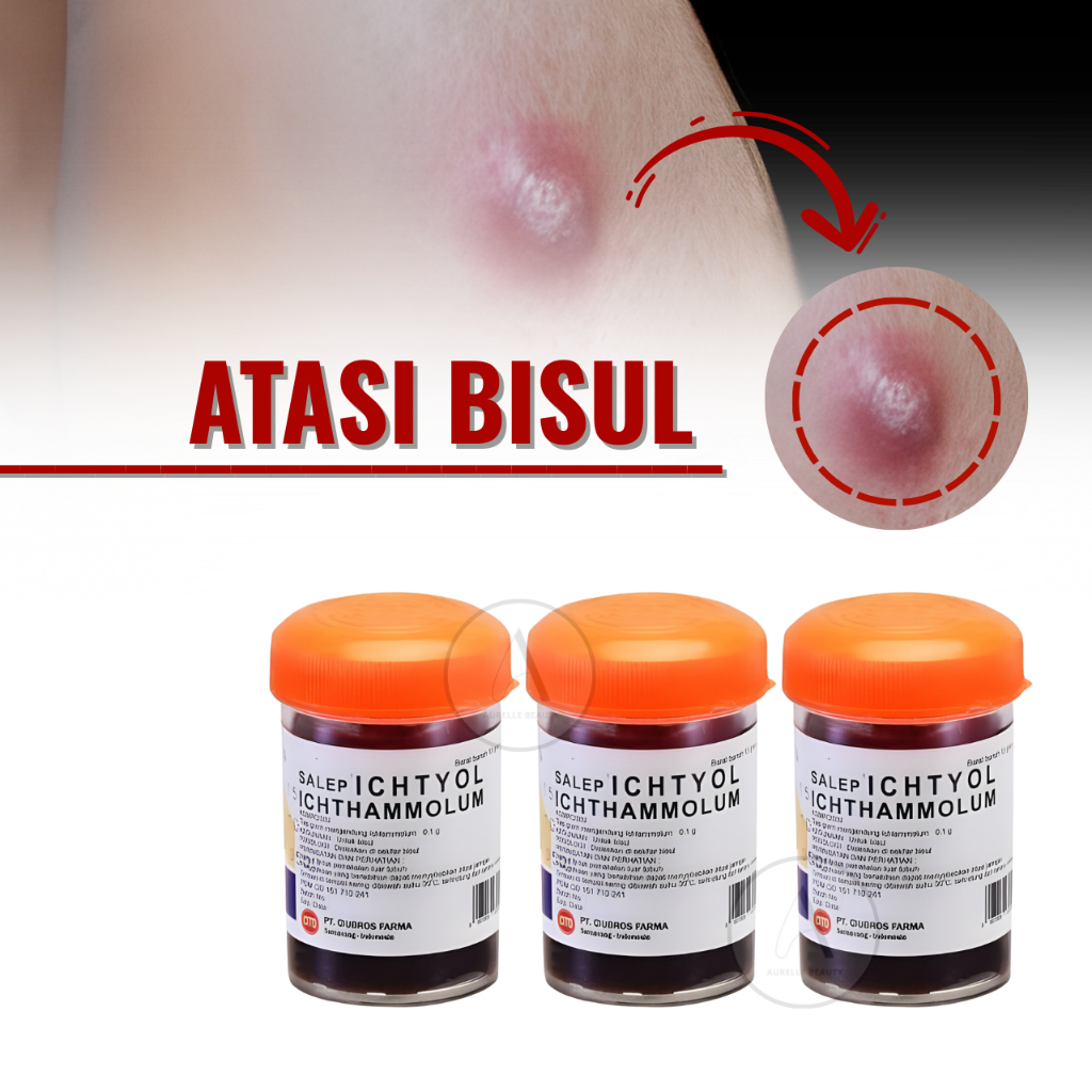 ICHTYOL Salep BPOM Ampuh Mengatasi Bisul Salep Hitam Khusus Bisul pada Tubuh Original