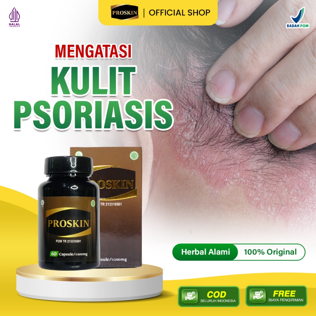 Proskin Herbal Asli – Obat Penyakit Autoimun Kulit: Psoriasis, Skleroderma & Lepuhan