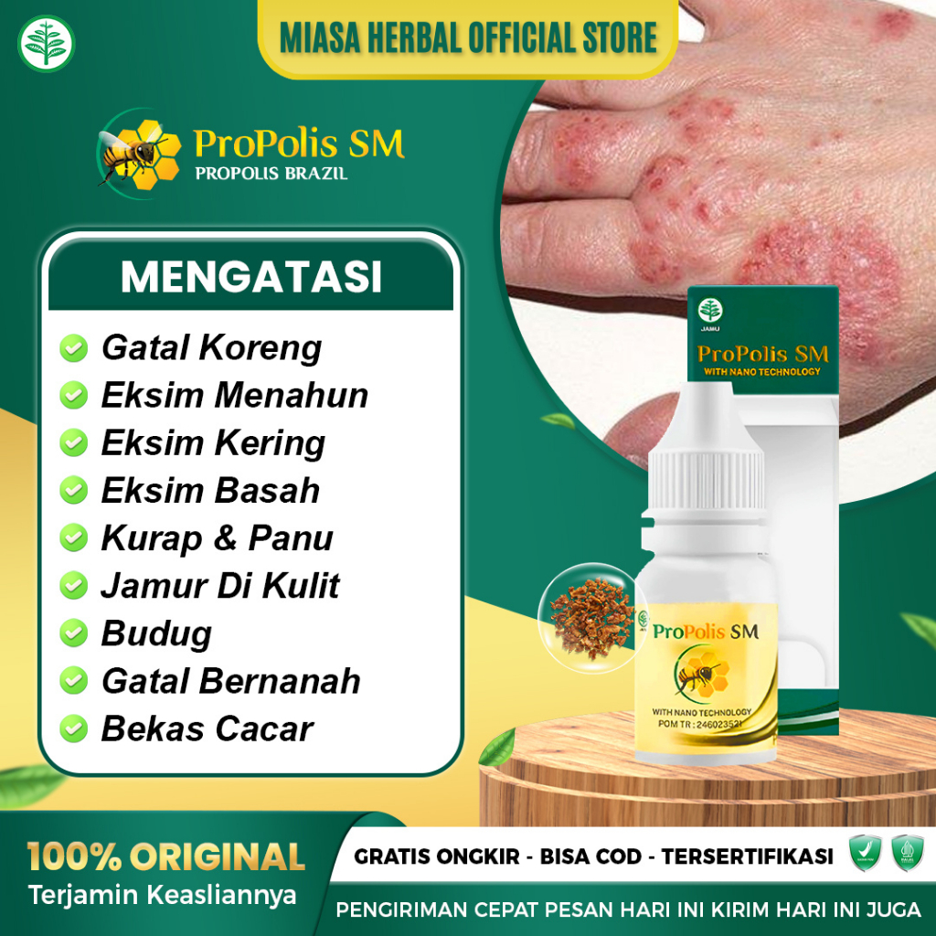Obat Gatal Korengan Eksim Menahun Kurap Panu Jamur Kulit Budug - Propolis SM