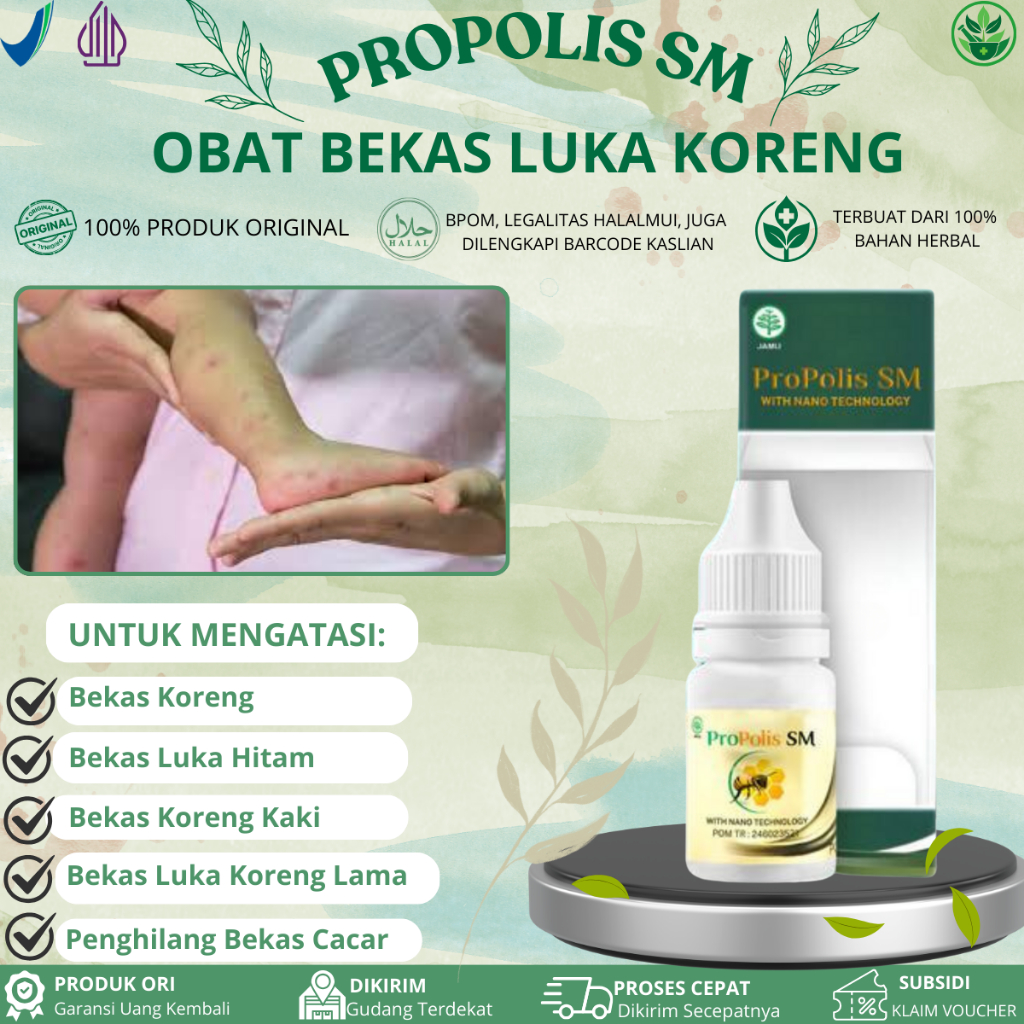 Obat Bekas Luka Koreng, Penghilang Bekas Luka Hitam,  Penghilang Bekas Cacar Bekas lama Propolis SM 