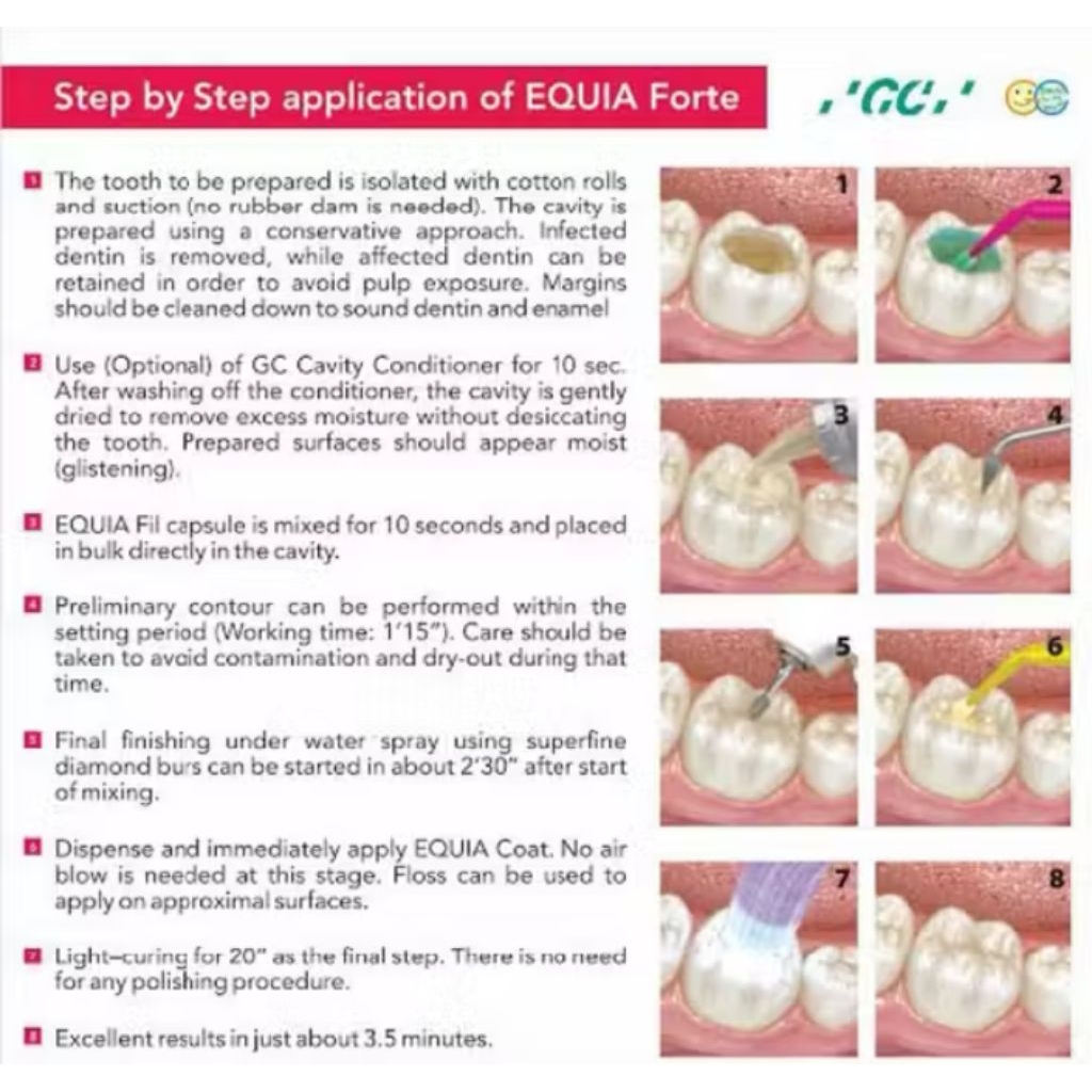 Equia Forte Coat GC 4 ml 2028