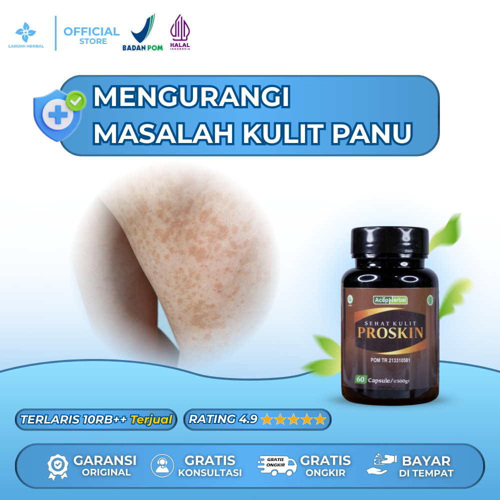 Proskin Kapsul - Obat Panu Asli mengatasi Panu Tanpa efek samping Aman BPOM dan Halal