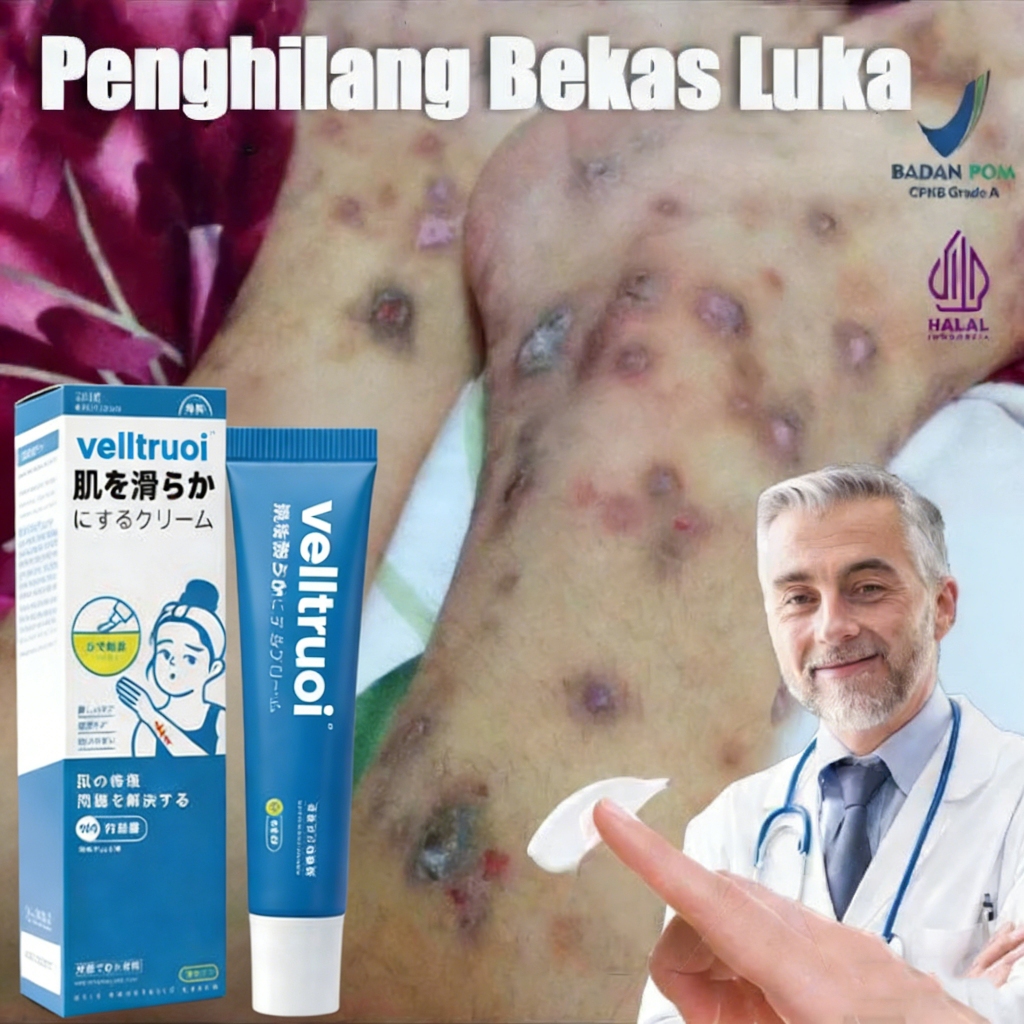 Penghilang bekas luka Penghilang bekas koreng hitam di kaki Penghilang Bekas cacar Bekas lama Bekas 