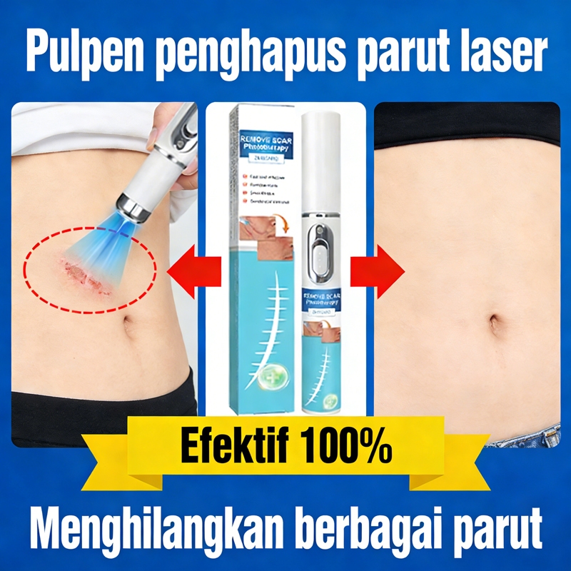 Menghilangkan Bekas Luka dengan Cepat Pena Laser – Efektif untuk Bekas Jerawat, Goresan & Bekas Luka