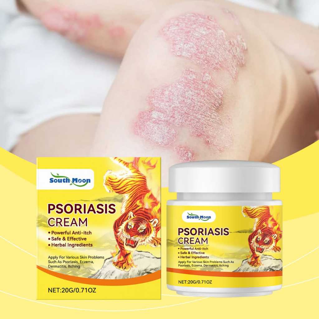 ORIGINAL Obat gatal Obat eksim Obat kurap RACIKAN JEPANG  Salep psoriasis Salep eksim 20g Obat kurap
