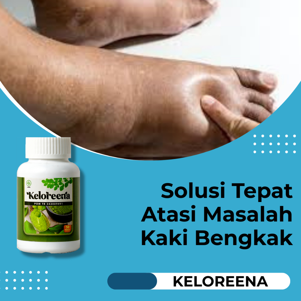Keloreena Kapsul Ekstrak Daun Kelor Obat Kaki Bengkak Pengempis Kaki Bengkak Meredakan Bengkak