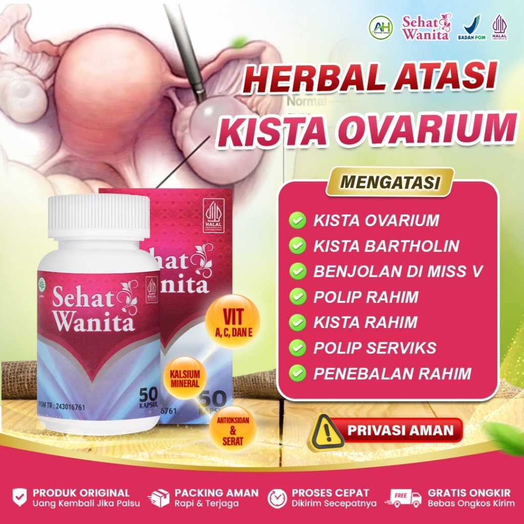 Obat Kista Ovarium, Kista Bartholin, Kista Epidermoid, Kista Endometriosis Kista Coklat Sehat Wanita