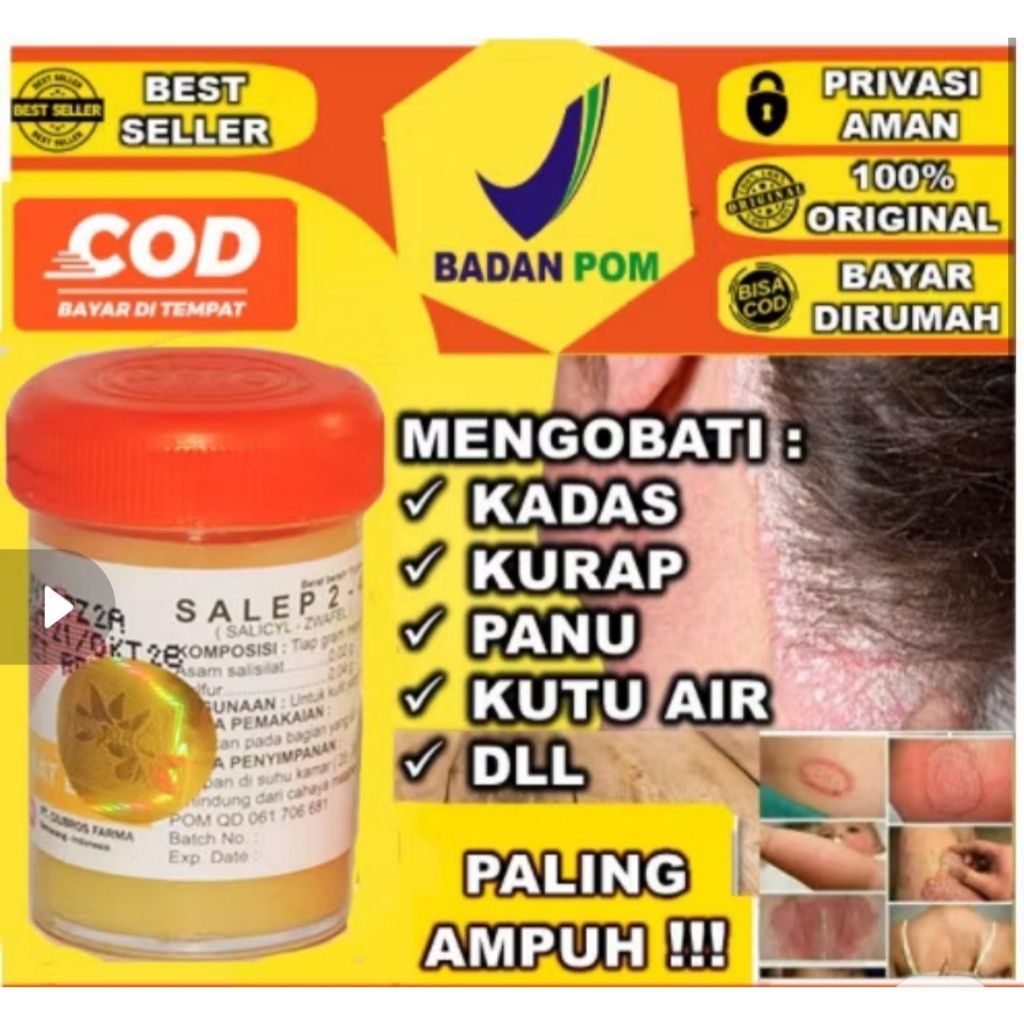 Obat SALEP ZWAFEL ITCHY 24 234 Belerang Sulfur 100% Original BPOM Salep Gatal Kutu Air Eksim Panu Ku