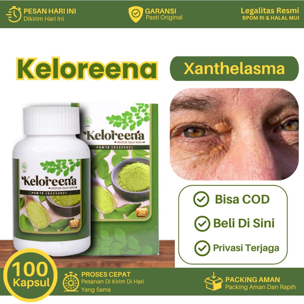 Obat Xanthelasma, Gumpalan Daging di Kelopak Mata, Plak Mata Kuning, Bintil Xanthelasma, Benjolan Xa