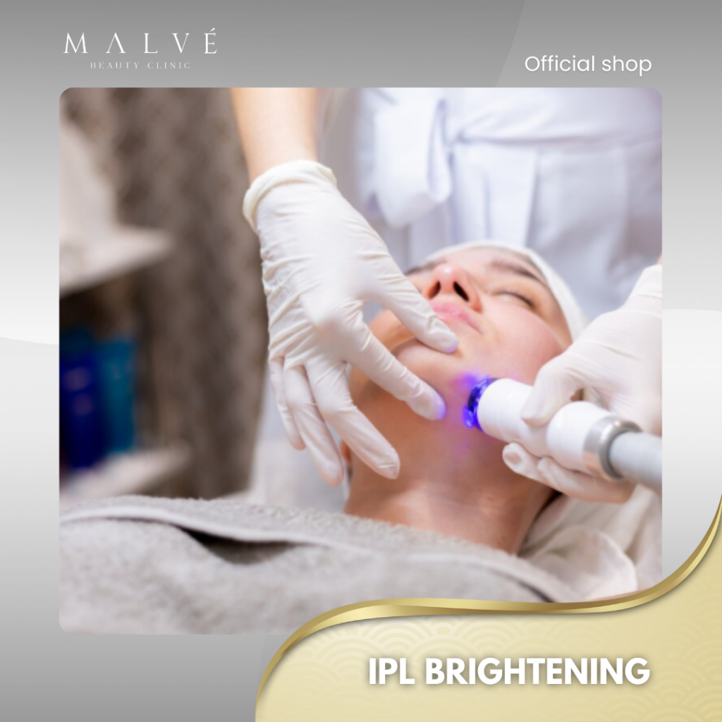 MALVE IPL Brightening Treatment