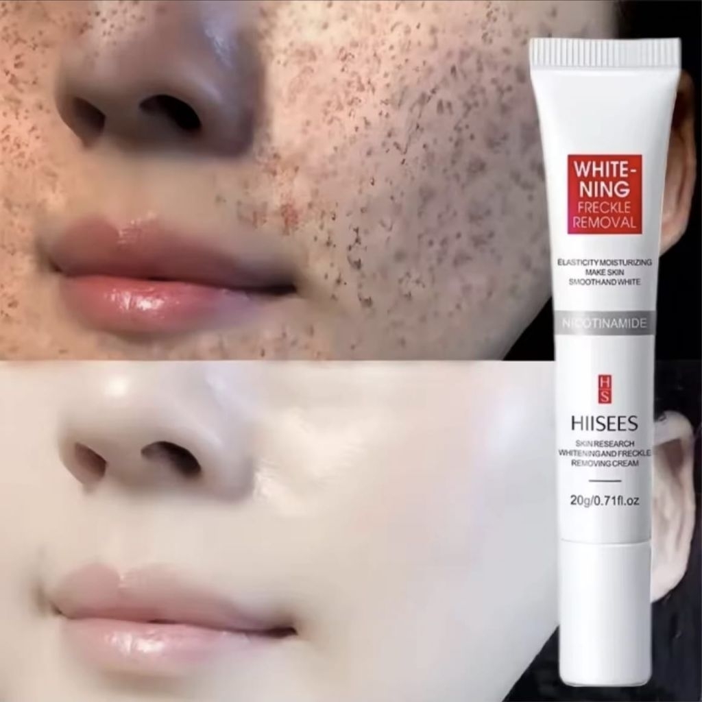 HISEES Dark Spots Penghilang Flek HitamMembandel Whitening Freckle Cream Remove
Dark Spots Anti Frec