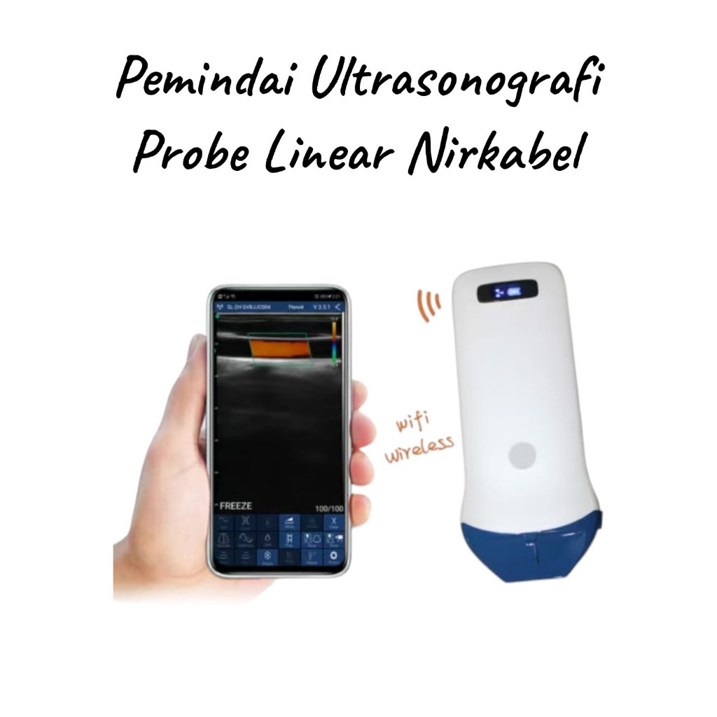Alat Medis USG Portable Linear Wireless Wifi Probe Ultrasond Scranner - Pemindai Ultrasonografi Prob