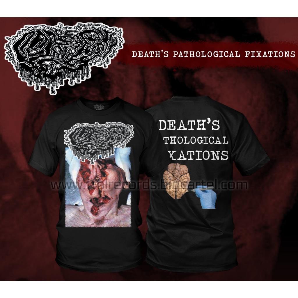 ORIGINAL TSHIRT FETAL DEFORMITY - Death's Pathological Fixations