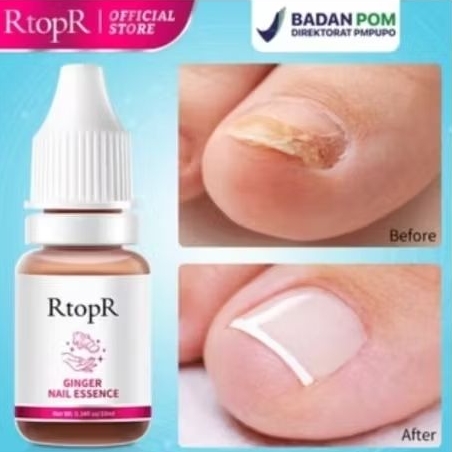 RtopR ESENSI KUKU GINGER Minyak Esensial Jahe 10ml