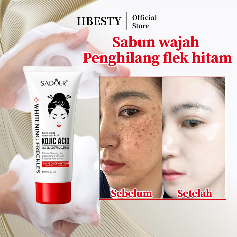 HBESTY Sabun wajah penghilang flek hitam Menghilangkan flek hitam di wajah Sabun pencuci muka flek h