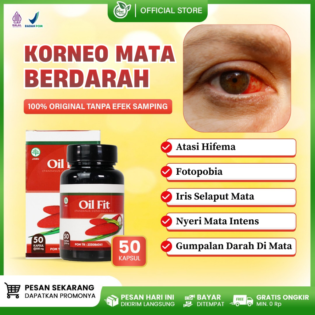 Obat Hifema Herbal, Gumpalan Darah Di Korneo / Iris Selaput Mata, Fotopobia, Nyeri Mata Intens - Oil