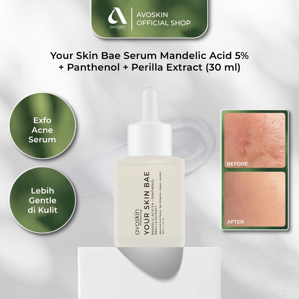 Serum Avoskin Your Skin Bae Mandelic Acid 30ml-Eksfoliasi & Jerawat