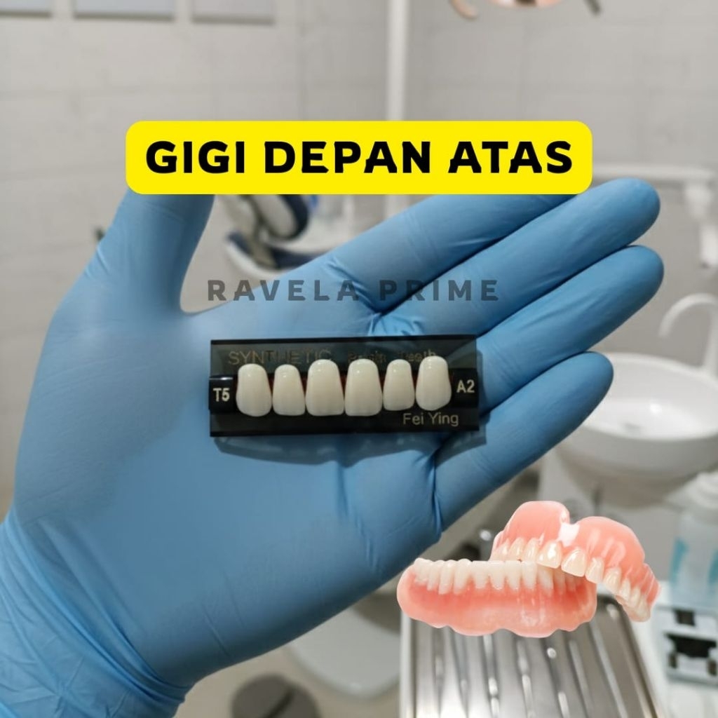 Gigi Palsu Premium Depan Atas – Gigi Saja, Pasang Mudah