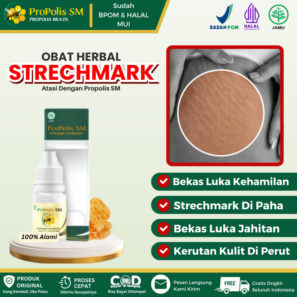 Obat Penghilang Strechmark, Bekas Luka Kehamilan, Strechmark Di Paha Bokong Pinggul Perut, Bekas Luk