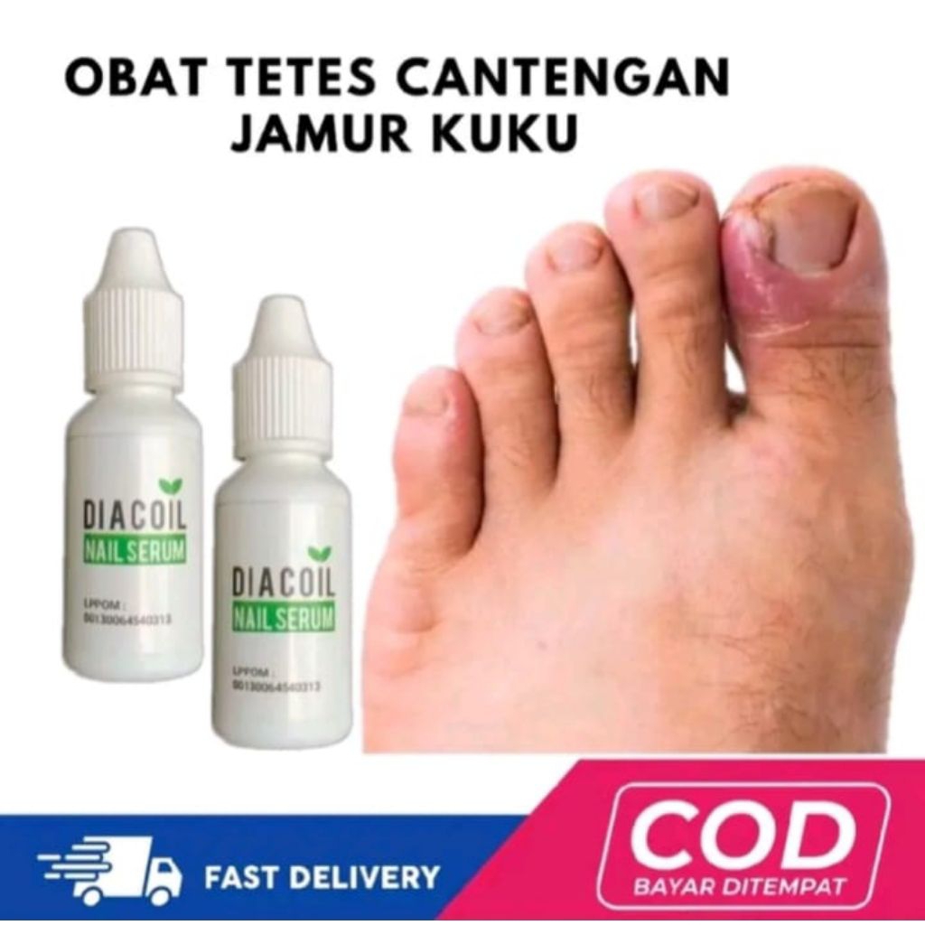 DIACOIL NAIL SERUM ORIGINAL | OBAT KUKU CANTENGAN | BERNANAH KUTIKULA | HALAL 100%