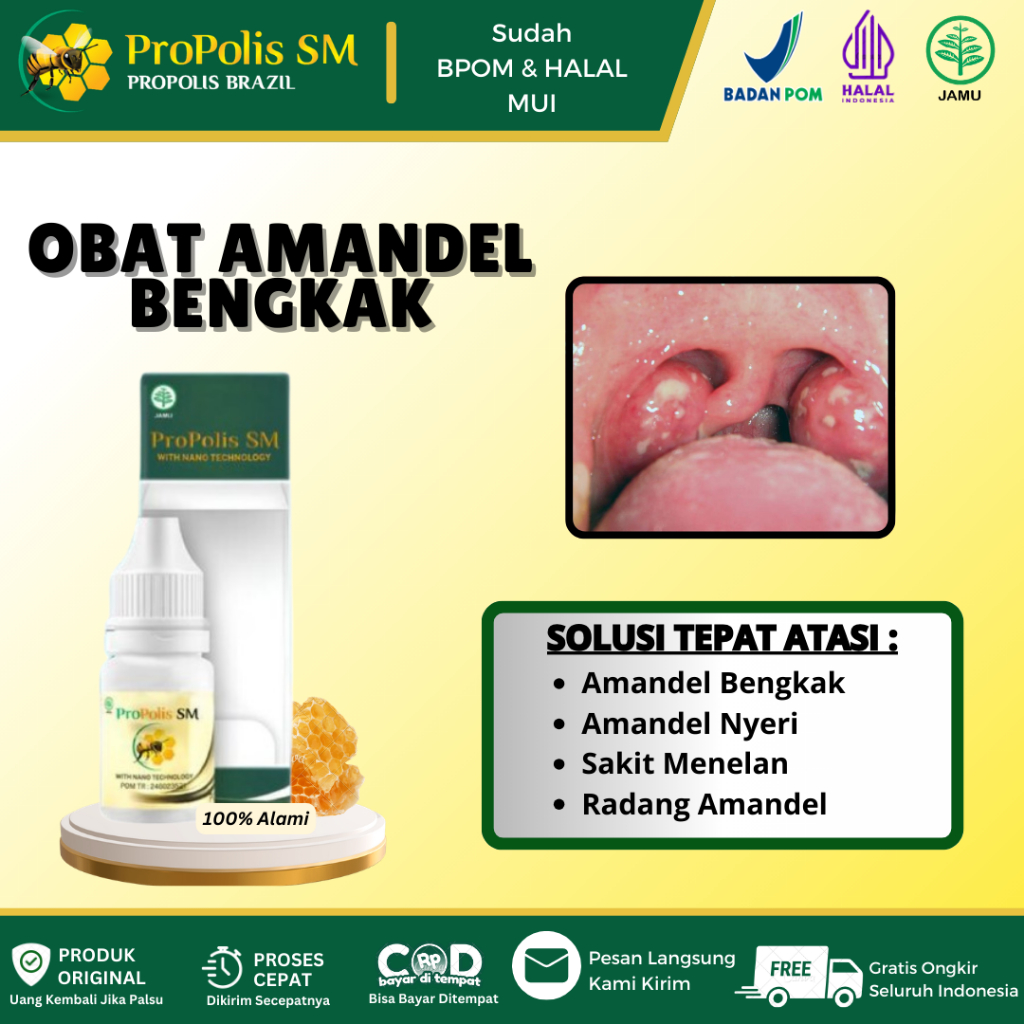 Obat Amandel Bengkak, Amandel Nyeri, Radang Amandel, Nyeri Saat Menelan, Amandel Bengkak Sebelah Ata