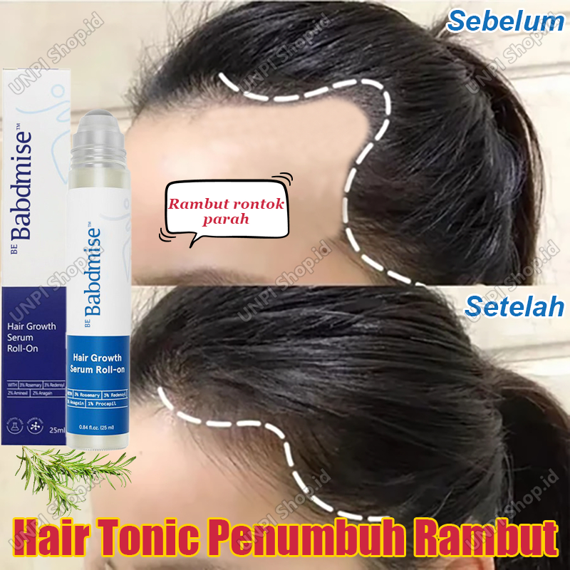 Hair Tonic Penumbuh Rambut  Botak Roller Rosemary Oil Rambut Minyak Penumbuh Rambut Cepat Dan Tebal 