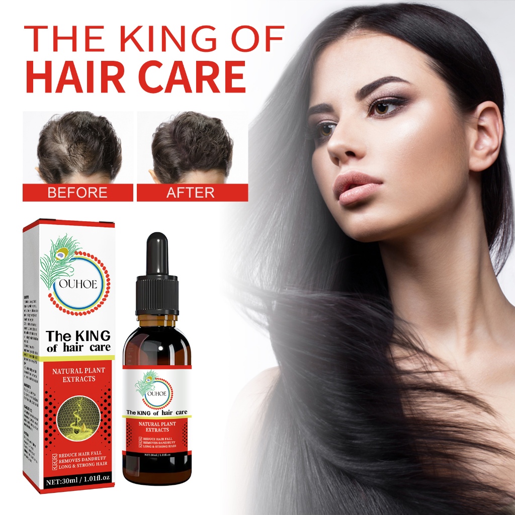OUHOE The King Of Hair Care 30ml Hair Growth Serum Reduce Hair Fall Long Strong Hair Removes Dandruf
