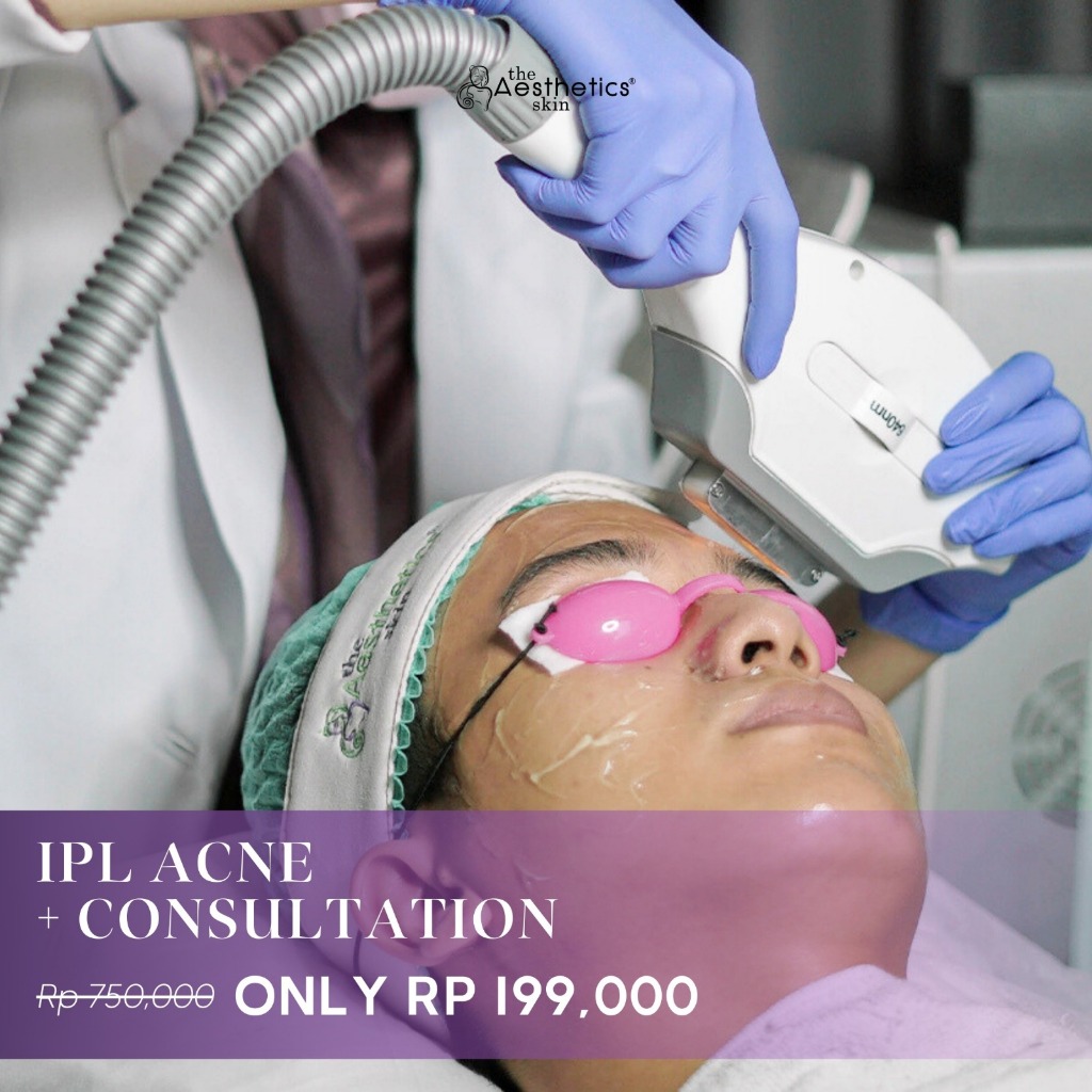 [Voucher + Consultation] The Aesthetics Skin IPL Acne